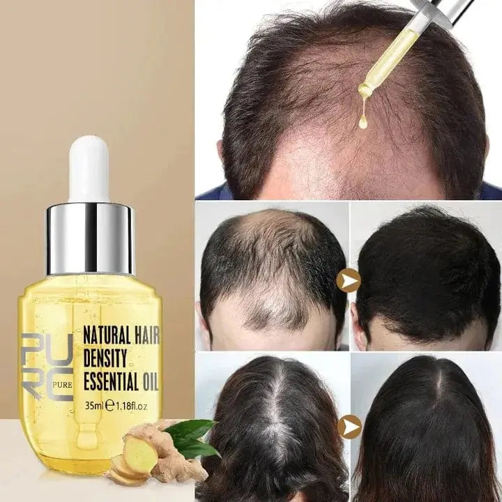 Hair Growth Essential Oil – Reclaim Your Luscious Locks! - EVERRD USA