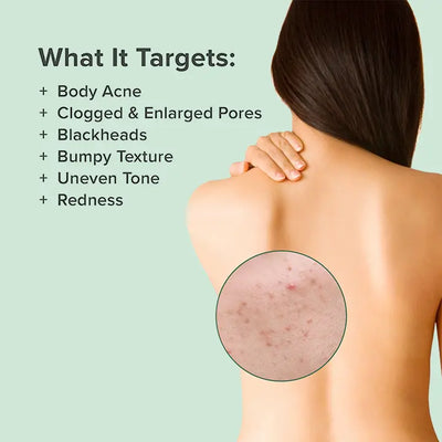 MEDix™ Back Acne Treatment Spray - EVERRD USA
