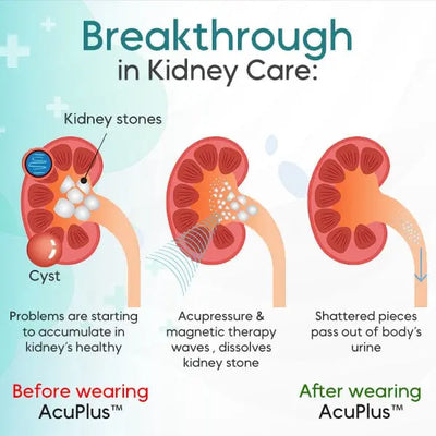 AcuPlus™ Kidney Care Point Clip - EVERRD USA
