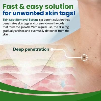 AEXZR™ Skin Spot Removal Serum - EVERRD USA
